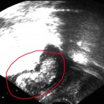 Ultraschall Bild meines Baby in der 11. Woche 11